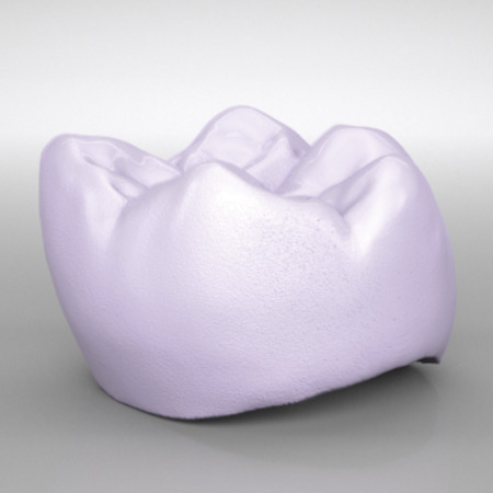 IPS e.max® CAD Kronen, HT und LT 