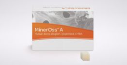 MinerOss™ A Unicortical Block 