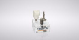 CONELOG® Makromodell PROGRESSIVE-LINE Implantat (Maßstab 3:1) 