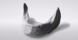 Zahnloser Unterkiefer inkl. Montageplatte 